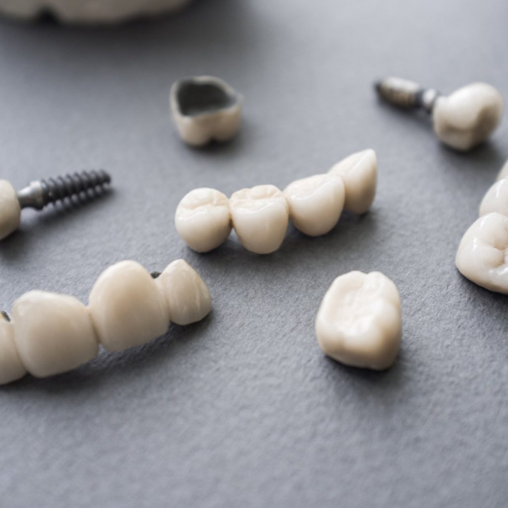 Imagens de dentes isolados e de coroas de dente, em cima de uma mesa