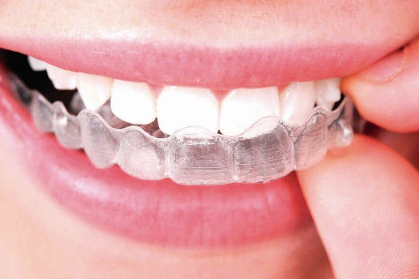 Tela close em um sorriso e, ao mesmo tepo, quero tecnologias e serviços embutidos